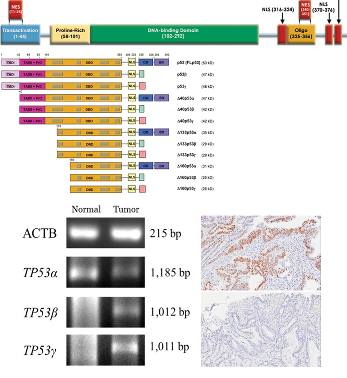 研究成果（ヒト大腸癌におけるTP53 splice variant発現解析）